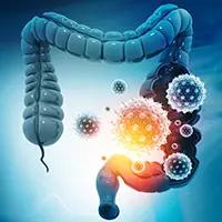 Gastric cancer | Image Credit: © Rasi - stock.adobe.com