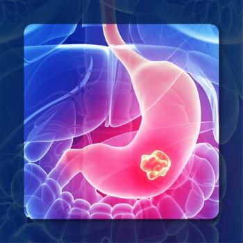 Microbiome in Cancer Treatment | Image Credit: © Crystal light – stock.adobe.com