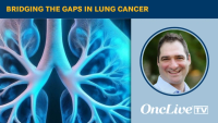 Bridging the Gaps in Lung Cancer | Image Credit: © Ashling Wahner & MJH Life Sciences Using AI