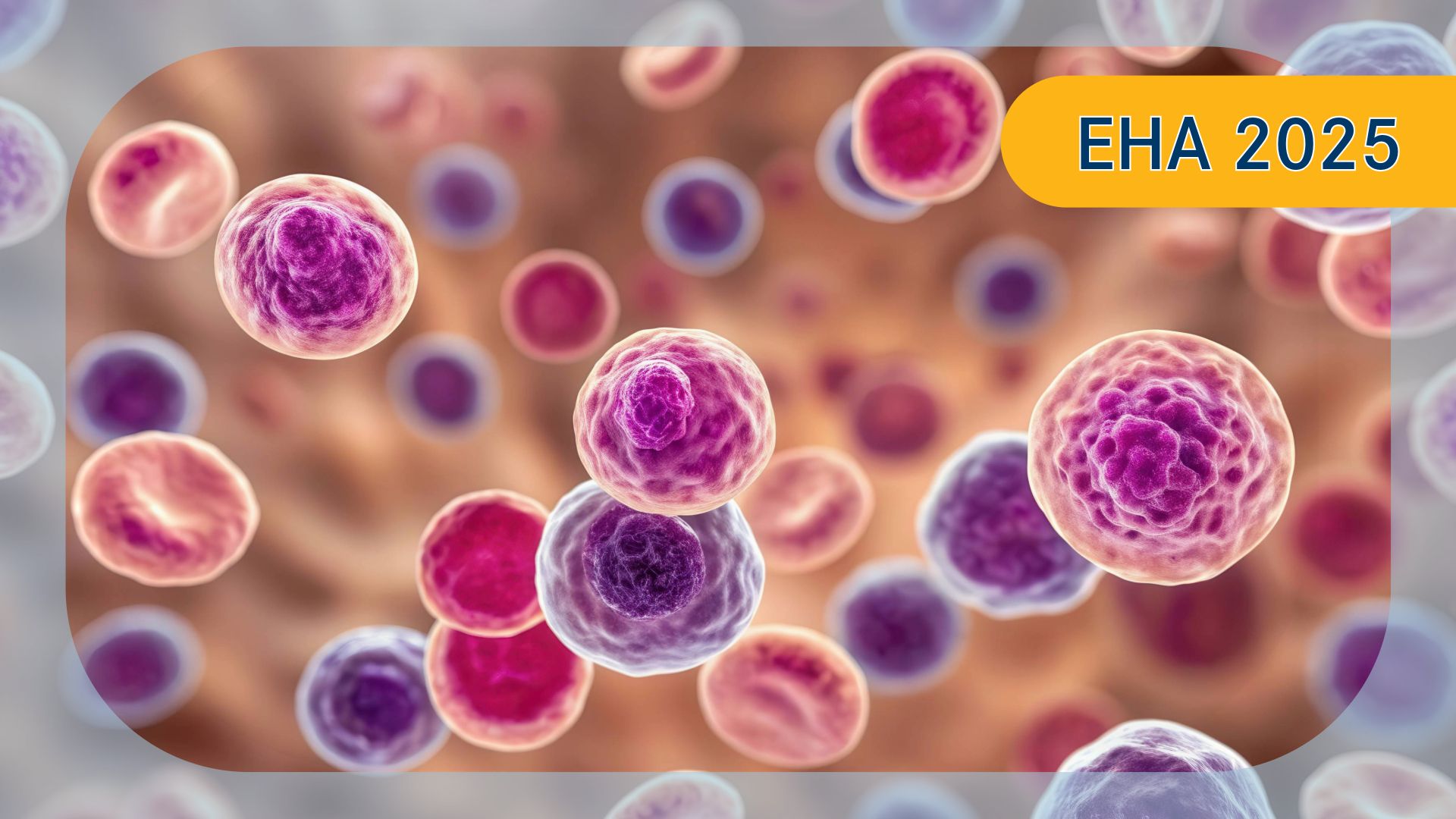 Waldenström Macroglobulinemia | Image credit:  © Brighting Collection - stock.adobe.com