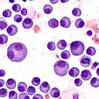 CAR T-Cell Therapy in Multiple Myeloma | Image Credit: © David A Litman - stock.adobe.com