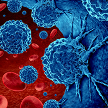 Non-Hodgkin Lymphoma |   Image Credit: © freshidea - stock.adobe.com