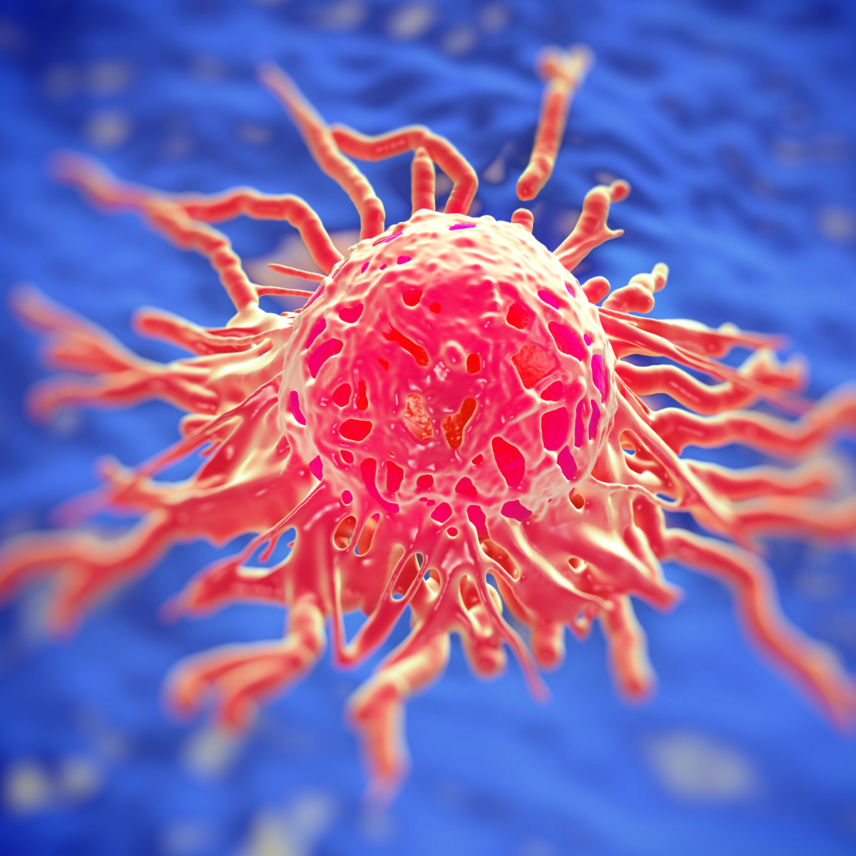 Urelumab Induces Additive Benefit With Vaccine/Nivolumab Combo in Pancreatic Cancer