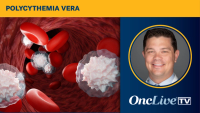 Andrew Kuykendall, MD, discusses how hepcidin-upregulating agents could transform hematocrit control for patients with polycythemia vera.