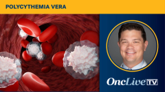 Andrew Kuykendall, MD, discusses how hepcidin-upregulating agents could transform hematocrit control for patients with polycythemia vera.