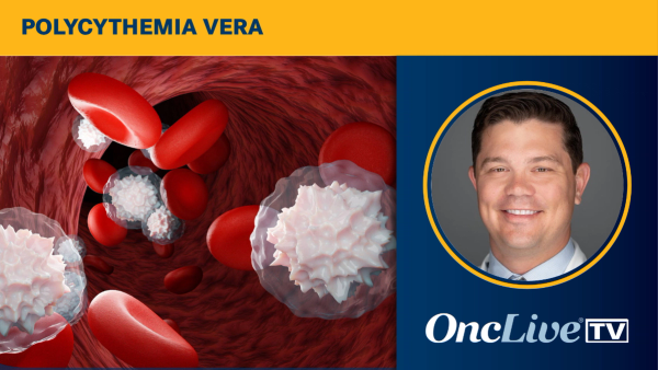 Andrew Kuykendall, MD, discusses how hepcidin-upregulating agents could transform hematocrit control for patients with polycythemia vera.