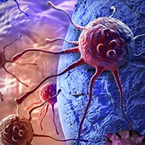 The Critical Role of Molecular Profiling in Cholangiocarcinoma