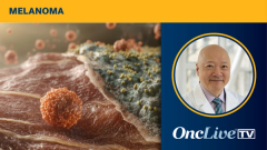 Vusolimogene oderparepvec-wtpg plus nivolumab in melanoma | Image Credit: © Galina - stock.adobe.com