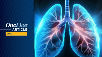 Treatment-Resistant Squamous NSCLC: ©Image by Ashling Wahner & MJH Life Sciences Using AI