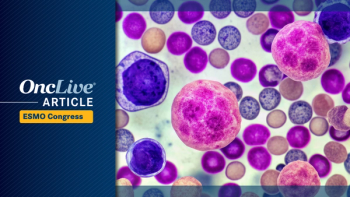 Hematologic Oncology |  Image Credit: © Curie  - stock.adobe.com