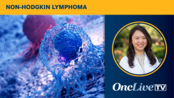 Dr Wang on the Efficacy of CNS Bridging Radiotherapy Prior to CAR T in B-Cell Lymphoma