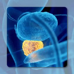 177Lu-PSMA-I&T Meets rPFS End Point in PSMA+ mCRPC