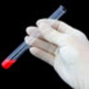 PSA Found to Be Highly Predictive of Long-Term Risk of Death From Prostate Cancer