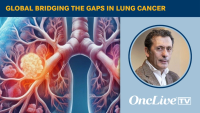 Global Bridging the Gaps in Lung Cancer | Image Credit: © Ashling Wahner & MJH Life Sciences Using AI
