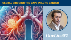Global Bridging the Gaps in Lung Cancer | Image Credit: © Ashling Wahner & MJH Life Sciences Using AI