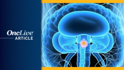 FDA Approval of Intravesical Mitomycin in NMIBC Follows ODAC Debate on Need for Randomized Data