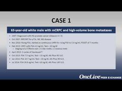 EP. 1 Treatment of Bone Metastases in Prostate Cancer
