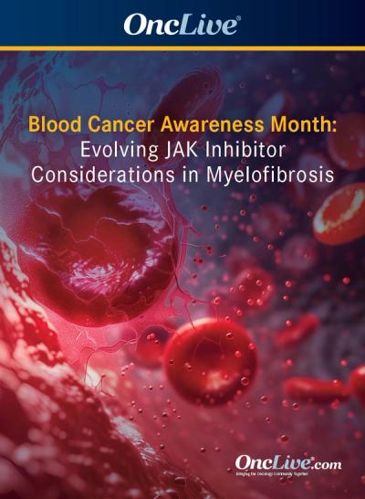 Experts outline evolving considerations for the use of JAK inhibitors in patients with myelofibrosis.