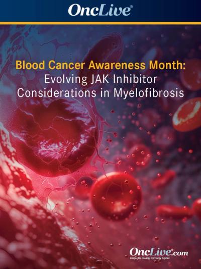 Experts outline evolving considerations for the use of JAK inhibitors in patients with myelofibrosis.