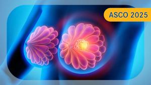 ER+/HER2– Breast Cancer | Image credit: © peterschreiber.media - stock.adobe.com