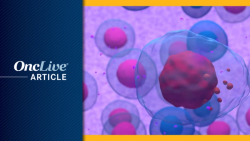 Real-World Data Show Hematologic Responses With Pacritinib in Myelofibrosis With Anemia