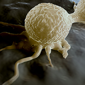 Novel Approaches to Metastatic HER2+ Breast Cancer