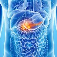 Pancreatic Cancer
