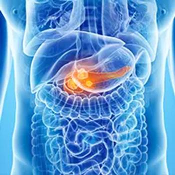 Pancreatic Cancer