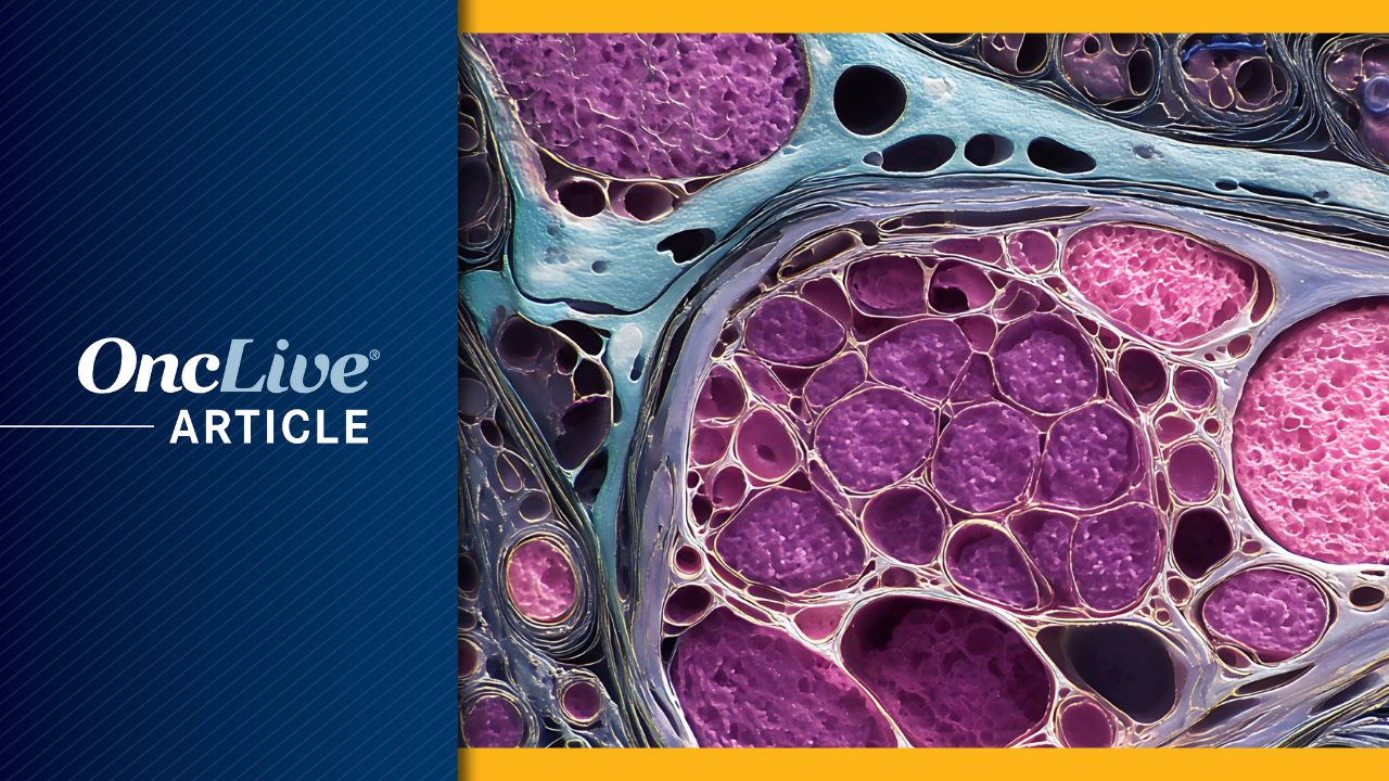 Toripalimab plus Chidamide in Sarcoma | Image Credit: © rinrada - stock.adobe.com