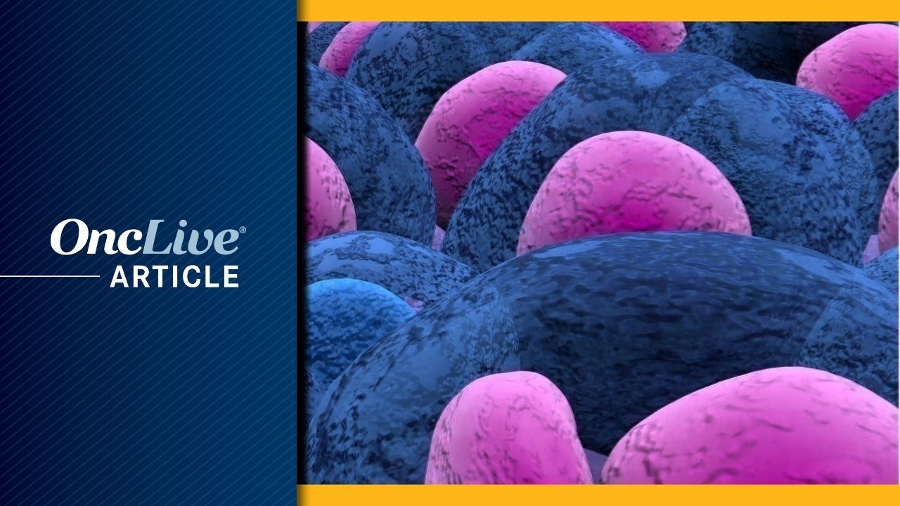 <![CDATA[Bone Marrow Immune Atlas Links Immune States to Disease Progression in Myeloma]]>