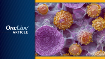 Tenosynovial Giant Cell Tumor | Image  Credit: © Best - stock.adobe.com