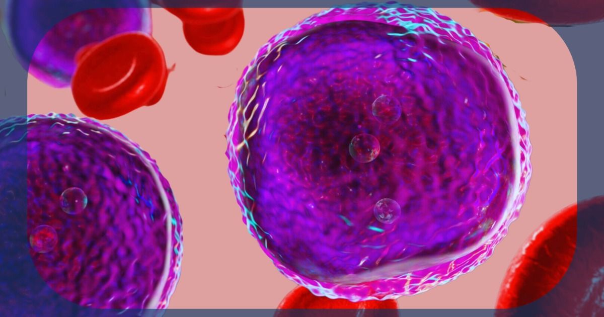 Rare and Aggressive Leukemia | Image Credit: © Bipul Kumar- stock.adobe.com