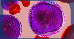 Yale Study: Potential Treatment Pathway Found for Rare and Aggressive Leukemia