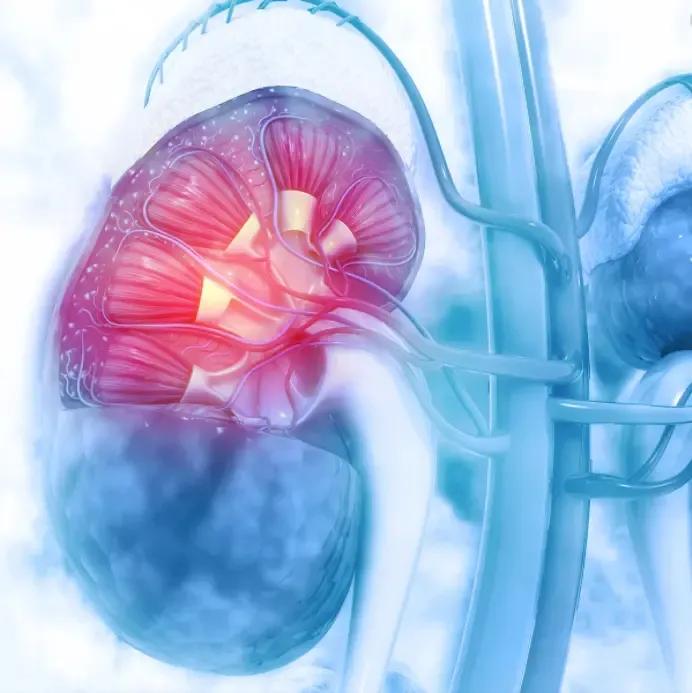 Renal Cell Carcinoma | Image Credit:   © Crystal light - stock.adobe.com