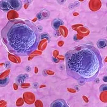 MRD Positivity in NPM1-Mutated AML | Image Credit: © LASZLO - stock.adobe.com