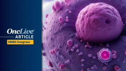OncLive Poll Results Spotlight Highly Anticipated Hematology Topics Ahead of ESMO 2025