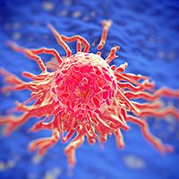 cervical cancer
