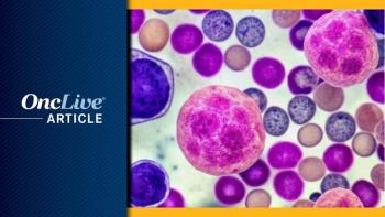 SC Isatuximab Via On-Body Injector for Multiple Myeloma | Image Credit: © Curie - stock.adobe.com (good for myeloma)