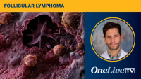 Daniel Morillo, MD, discusses AEs associated with golcadomide plus rituximab in relapsed/refractory follicular lymphoma.