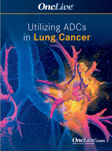 Utilizing Antibody-Drug Conjugates and Other Novel Agents in Lung Cancer