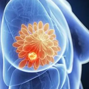 Single-Agent Trastuzumab Yields Superior Health-Related QoL in HER2+ Breast Cancer 