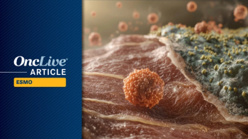 Uveal Melanoma | Image Credit: © Galina - stock.adobe.com