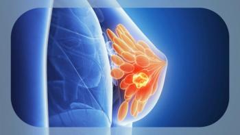 HER2-positive Breast Cancer | Image credit: © Sebastian Kaulitzki - stock.adobe.com