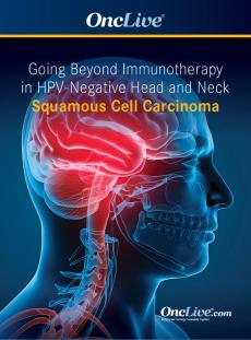Going Beyond Immunotherapy in HPV-Negative Head and Neck Squamous Cell Carcinoma