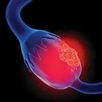 When maintenance niraparib was administered at an individualized starting dose, it resulted in a statistically significant and clinically meaningful improvement in progression-free survival vs placebo in patients with newly diagnosed ovarian cancer, irrespective of biomarker status.