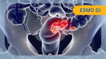 mCRC | Image Credit: © Anatomy Insider - stock.adobe.com