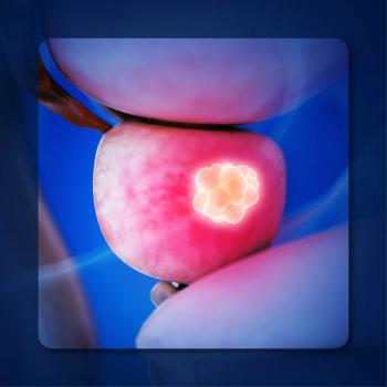 Prostate Cancer | Image Credit: © Sebastian Kaulitzki – stock.adobe.com