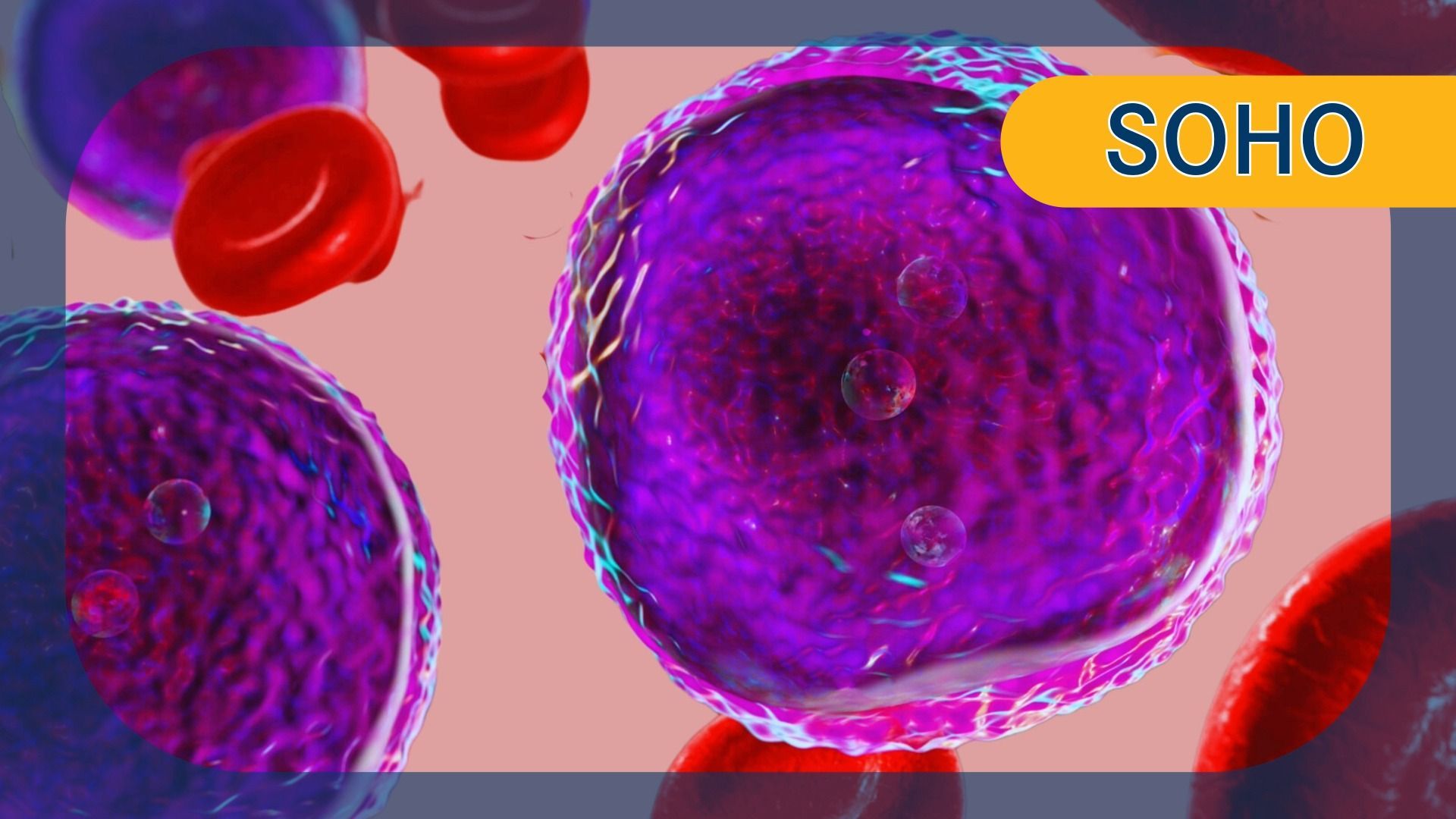 Mosunetuzumab/Polatuzumab Vedotin in R/R MCL | Image Credit: © Motion Pics - stock.adobe.com