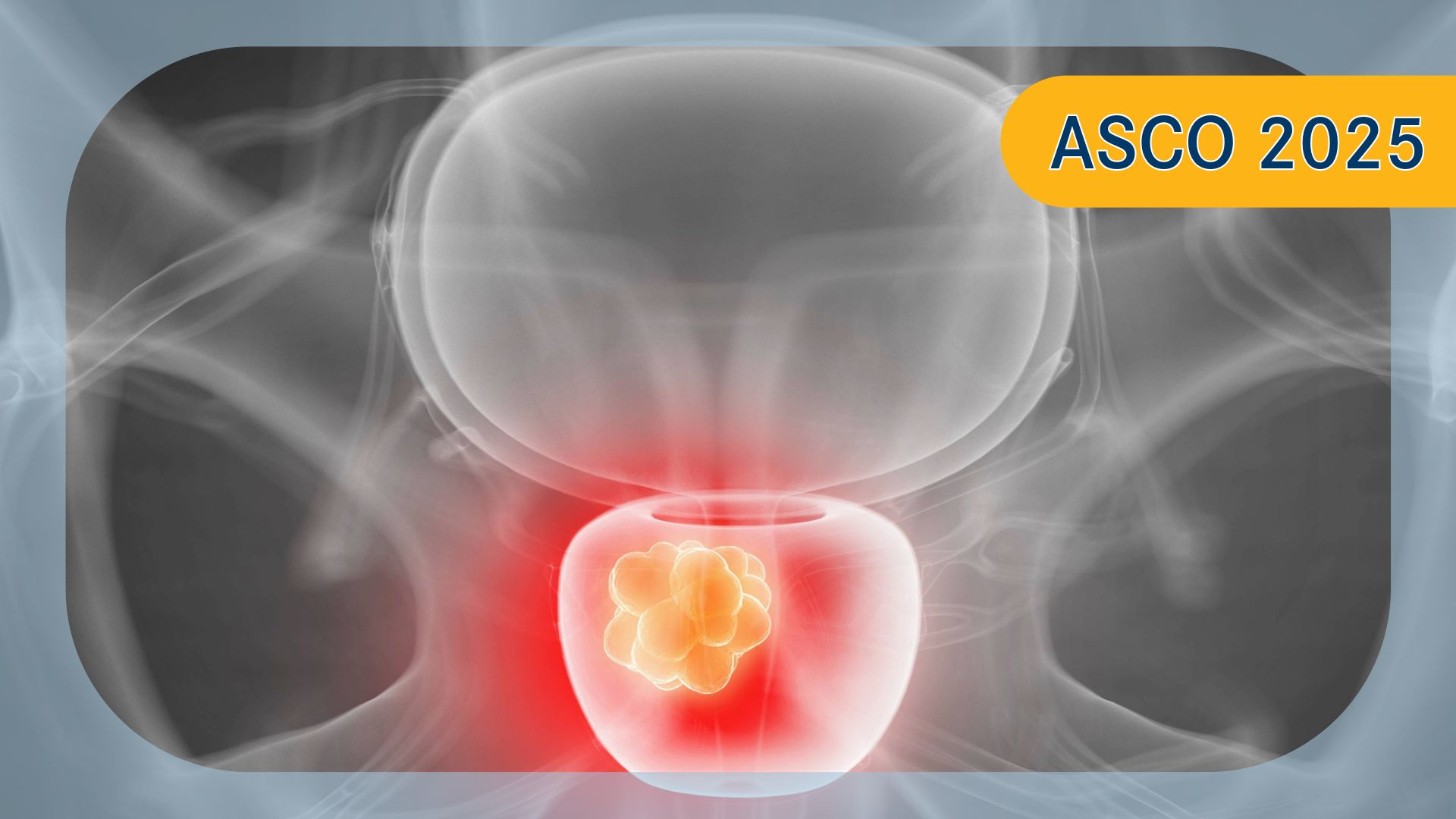 Darolutamide Plus ADT in Metastatic Hormone-Sensitive Prostate Cancer | Image Credit: © Sebastian Kaulitzki - stock.adobe.com