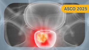 Darolutamide Plus ADT in Metastatic Hormone-Sensitive Prostate Cancer | Image Credit: © Sebastian Kaulitzki - stock.adobe.com